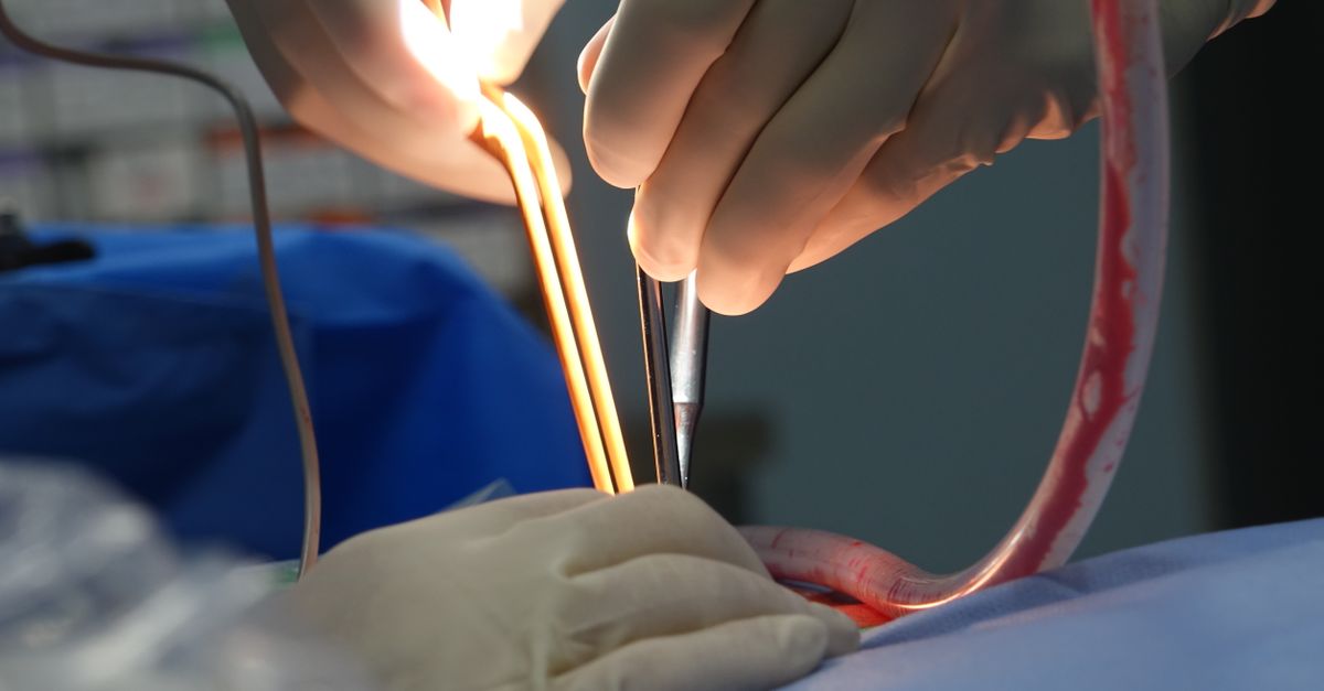 découvrez le coût d’une anesthésie générale et les facteurs qui influencent son prix, notamment l’intervention, la durée et la couverture d’assurance.